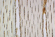 Biodiesel From Trees Biodiesel From Trees